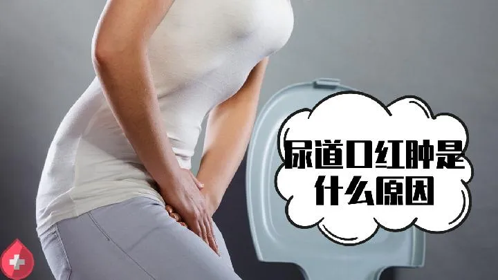 哪些人易患糖尿病？这三类人要注意了