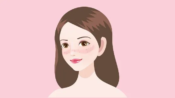 彩光复合祛斑效果如何