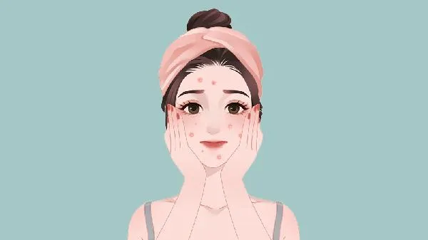 背部痘痘多什么原因