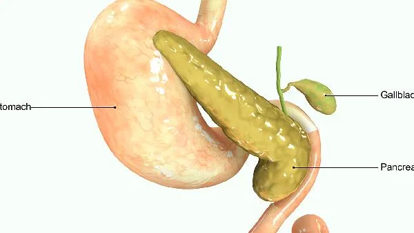 胰腺瘤是怎么引起的