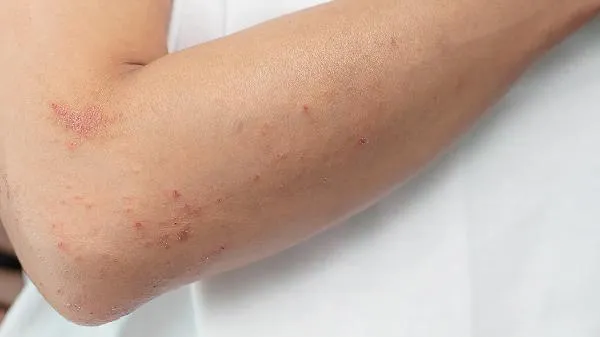 最近突然发胖是什么原因该怎么办
