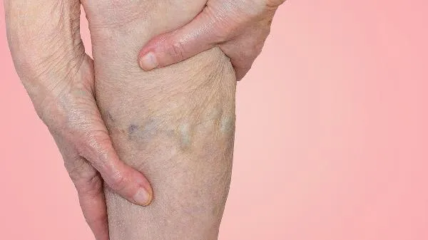 老年人痛风中医如何治疗