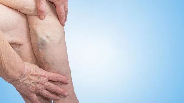 当今怎样能瘦肌肉型小腿？