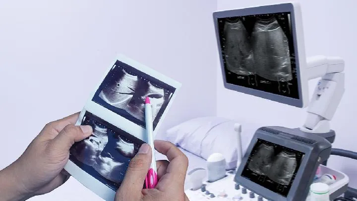 如何减去腹部赘肉 5种方法狂甩腹部赘肉