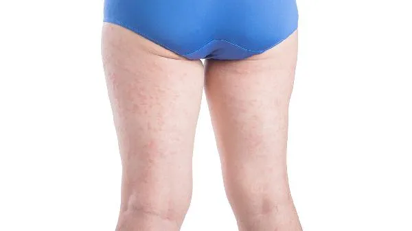 怎么锻炼大腿内侧的肌肉最有效果