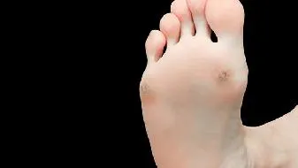 夜尿多当心暗藏着4种疾病