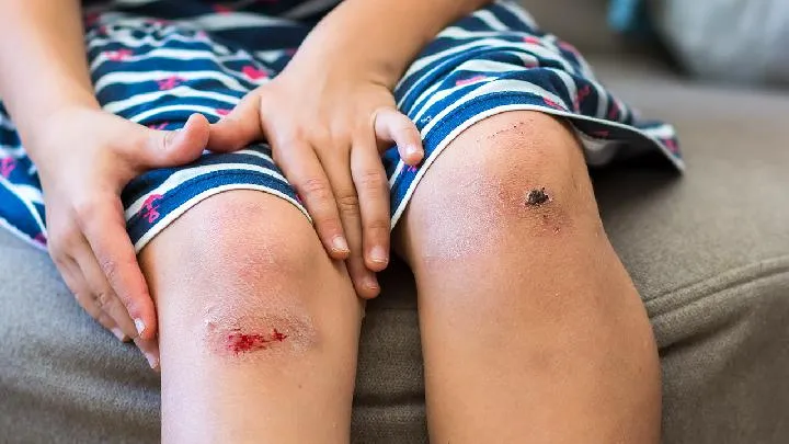 跑步后小腿跟腱疼痛的原因