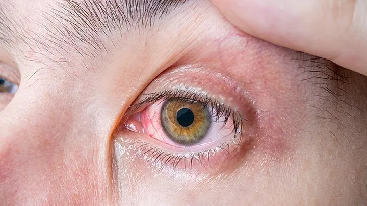 对眼睛好的维生素是哪一种