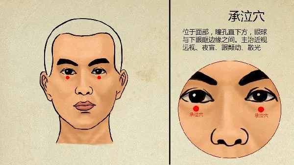 中医经络减肥有效吗