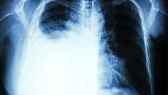 灯能为你驱逐黑暗也能给你带来癌症
