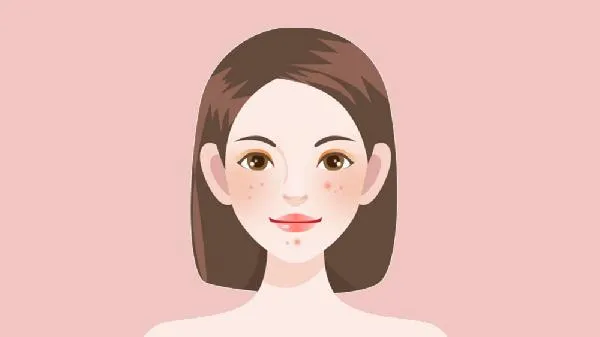 早睡早起痘痘会消吗