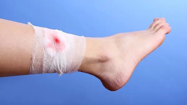 肌肉腿怎么瘦？常用方法有哪些