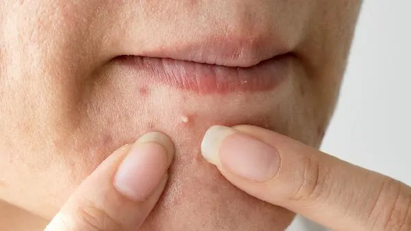 明明很瘦但是脸上肉多是什么原因
