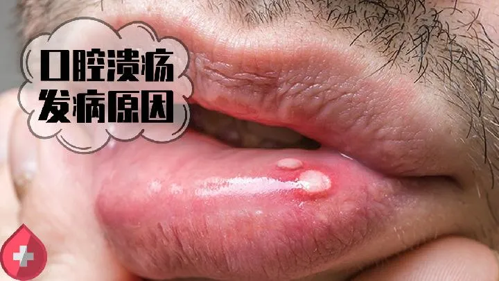 饮食减肥每顿饭都要注意这些事情