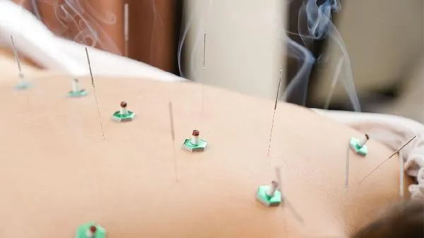 用艾灸肚子能起到减肥作用吗