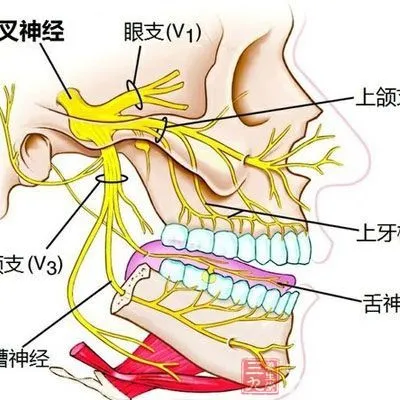 耳朵前面三叉神经痛图片