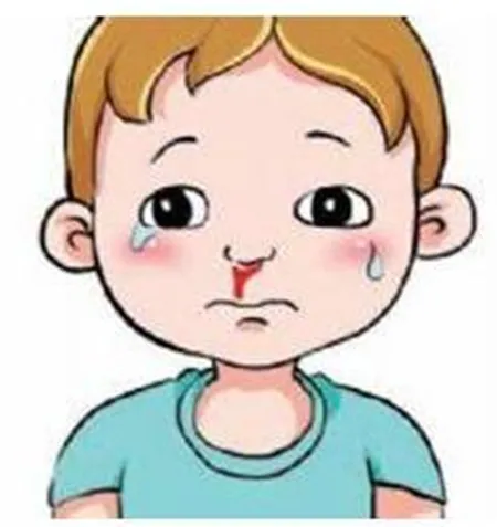 流鼻血怎么排除白血病 那些因数容易出现流鼻血呢