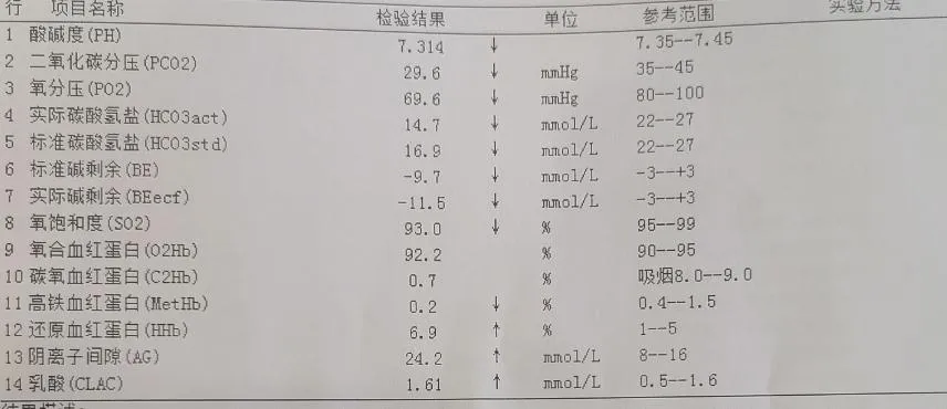 糖尿病酮症酸中毒