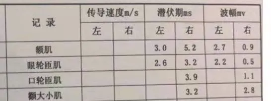 吵架后竟然会引起面肌痉挛