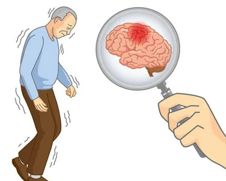 秋冬季气温骤降，预防脑中风要做好这些事