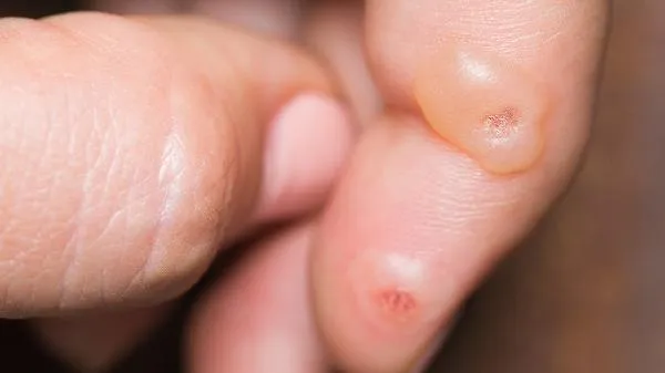 黑枸杞能泡几次 黑枸杞用热水泡还是冷水泡