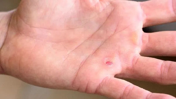 菠萝蜜剥完怎么洗手 吃菠萝蜜时拿盐水泡是为什么