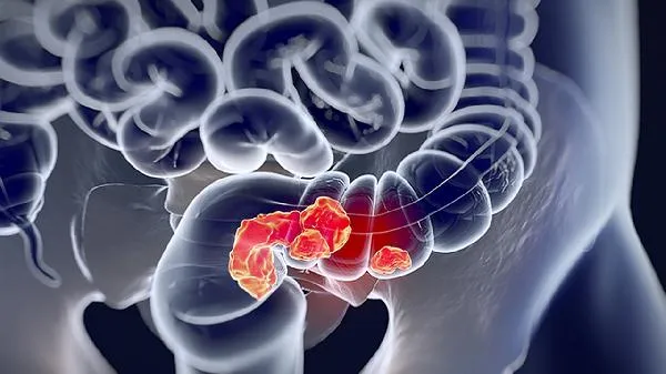 如何炖筒子骨汤好喝