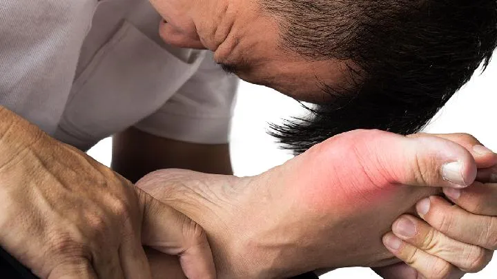 非布司他片作用与功效