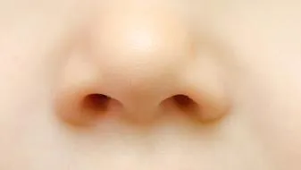 鼻息肉引起的原因是哪些  可以不做手术吗？