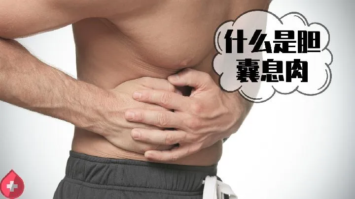 冬天吃牛肉的好处是什么 冬天吃牛肉注意3大禁忌