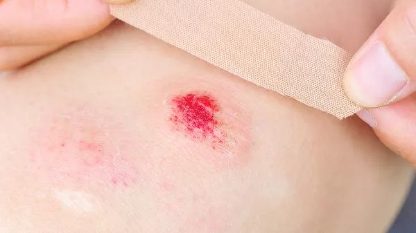 豆奶是发物吗伤口愈合