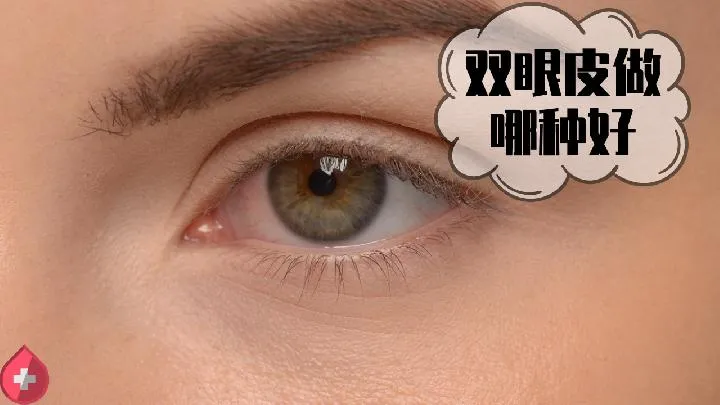 眼睑下垂，打了肉毒素，一个月可以恢复吗